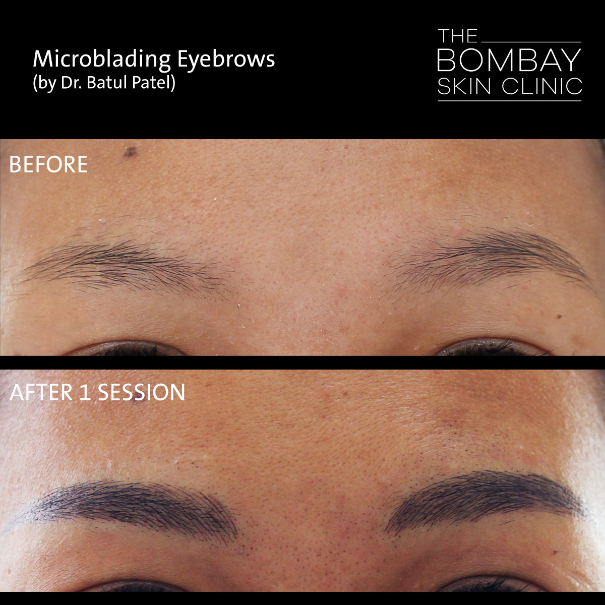 Microblading before after