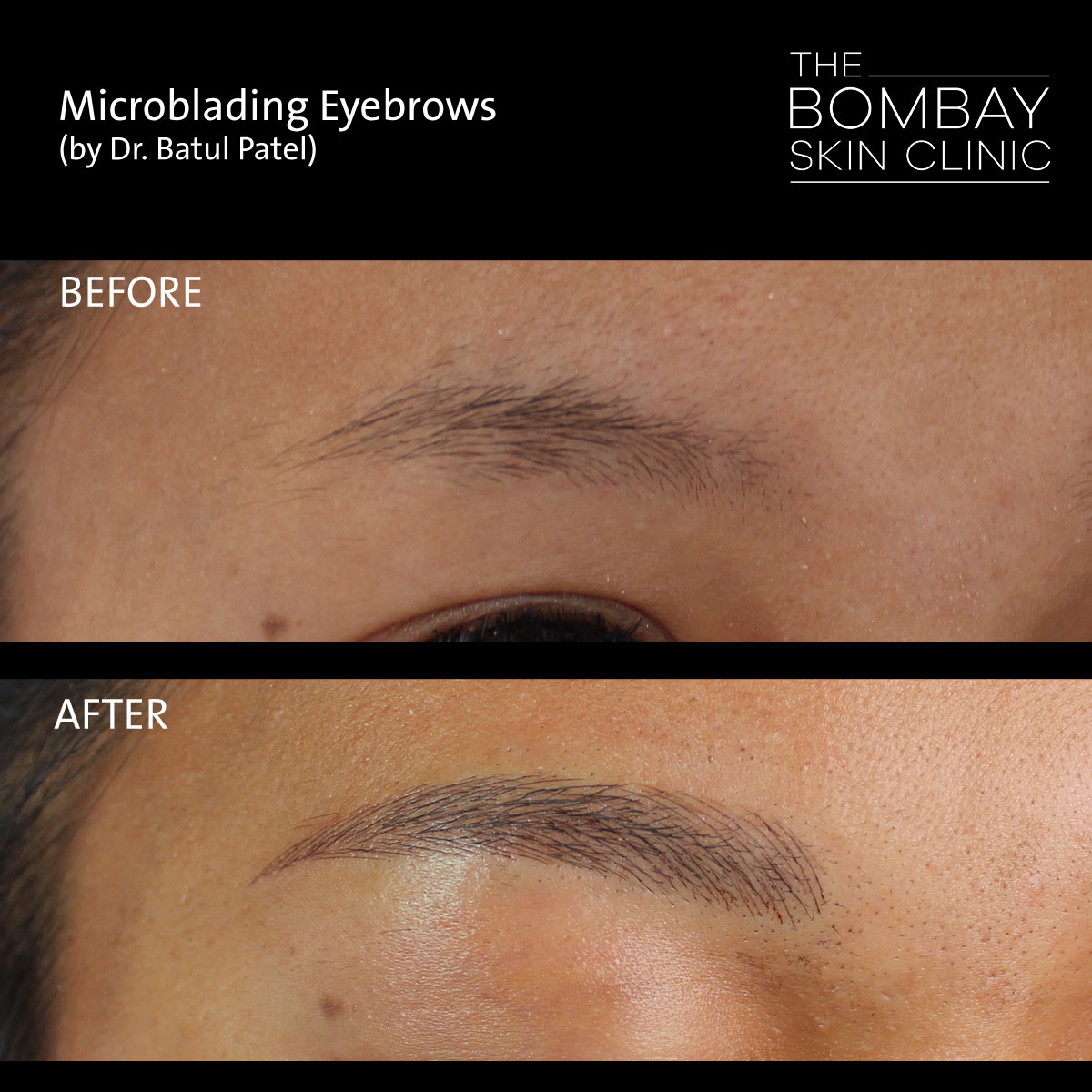 Microblading Eyebrows Before After