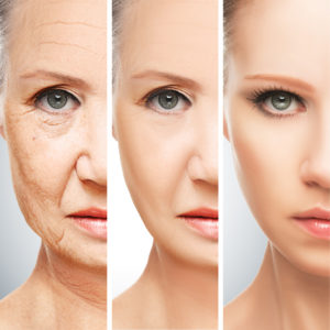 anti aging