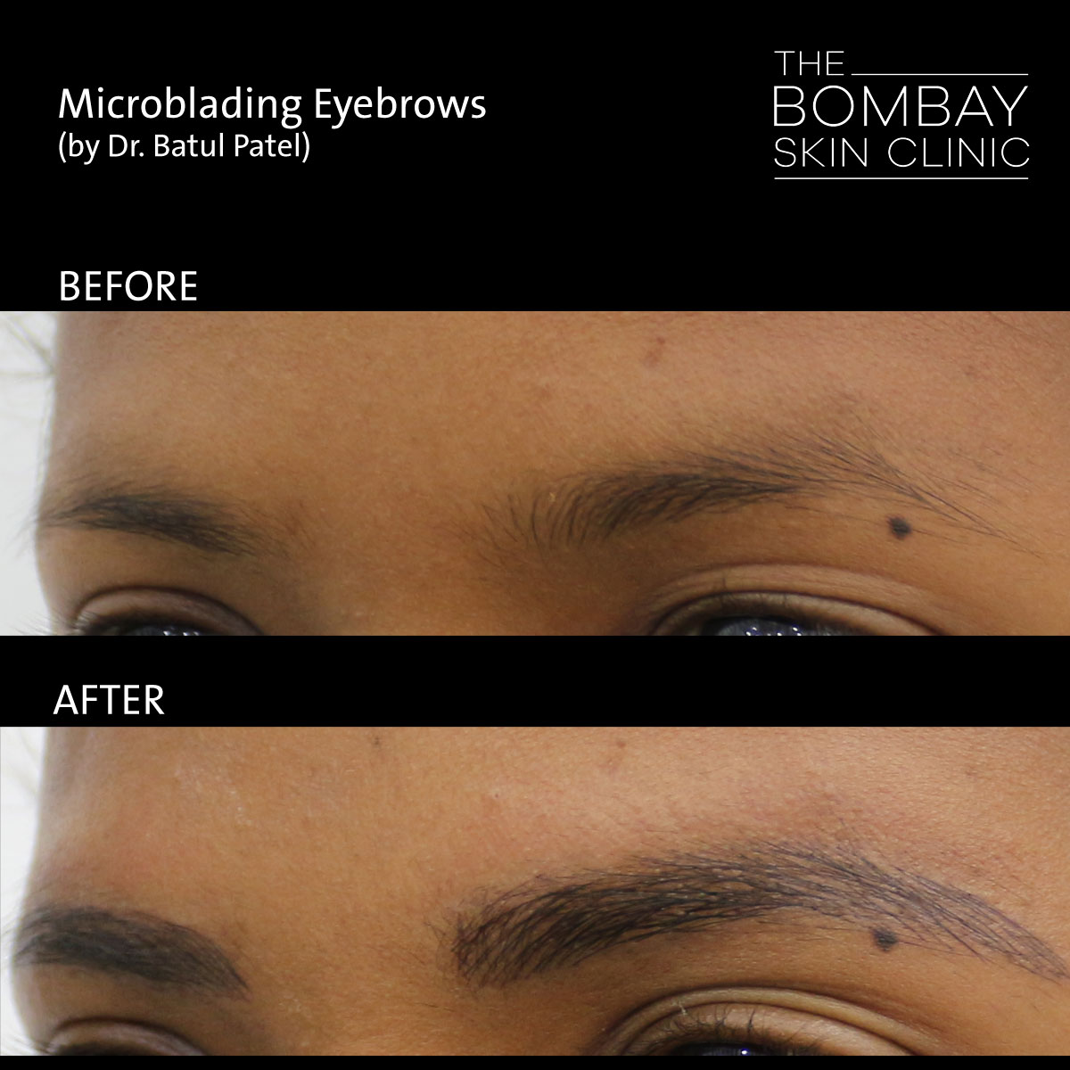 Microblading Before After Eyebrows Picture