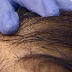 Regenera Activa Application