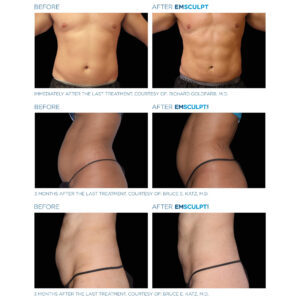 emsculpt fat reduction mumbai
