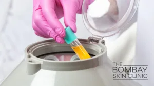 PRP-Treatment-for-Hair-in-Mumbai