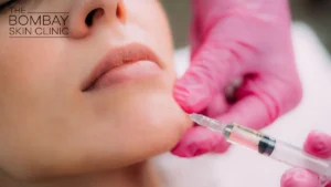 Dermal-filler