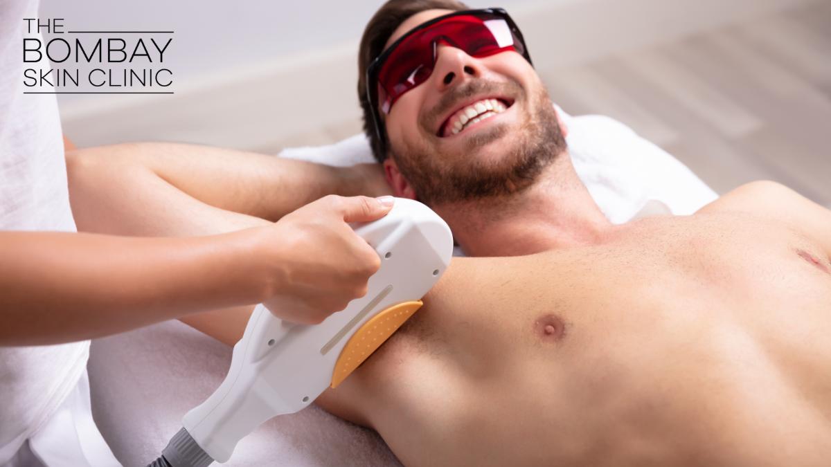 Laser Hair Removal for Men