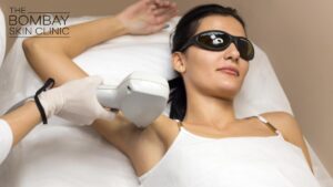 laser hair removal treatment in mumbai