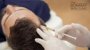 PRP_Treatment_for_Hair