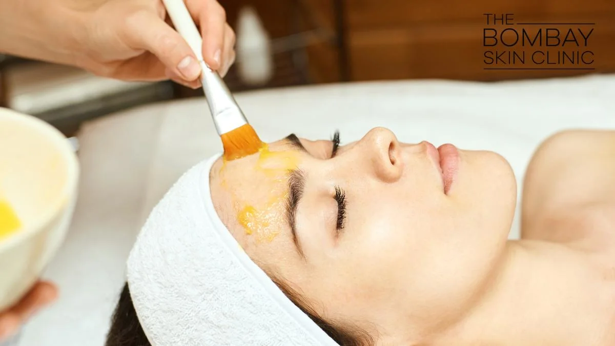Yellow_Peel_Treatment