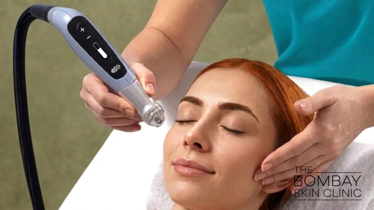 emfusion-treatment